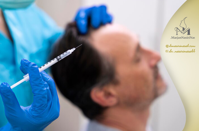 تفاوت مزوتراپی مو و کاشت مو