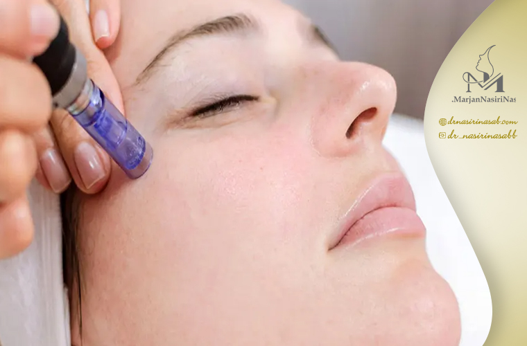 سوالات متداول در زمینه انجام میکرونیدلینگ