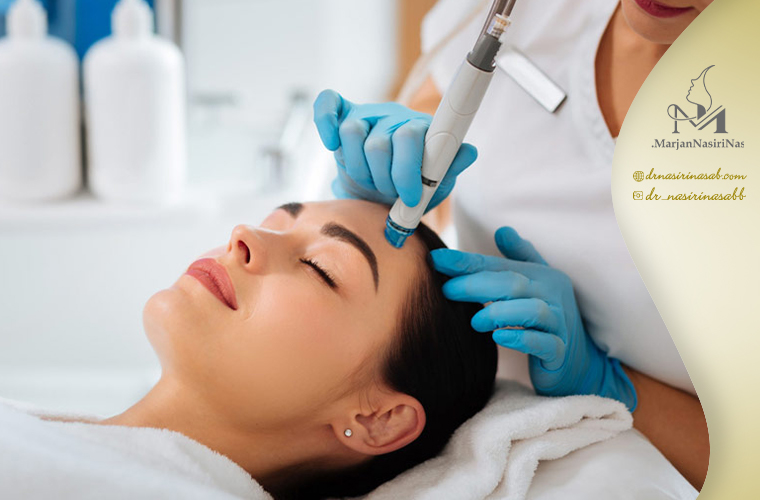 مزایای میکرونیدلینگ